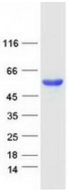 Coomassie blue staining of purified PTEN protein.